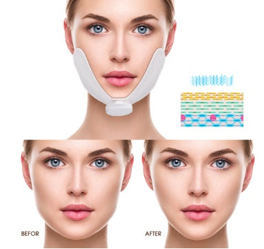 V-Shape EMS Facial Lifting Device
